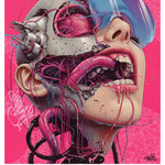 Implant